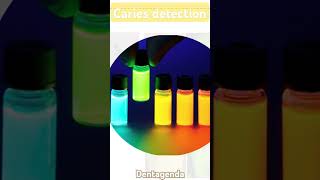 Caries detection methods  fiber optic transillumination [upl. by Etta492]