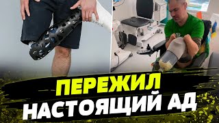 Кадыровцы АМПУТИРОВАЛИ ВСЕ ЧЕТЫРЕ конечности В это СЛОЖНО ПОВЕРИТЬ история украинского защитника [upl. by Chapland463]