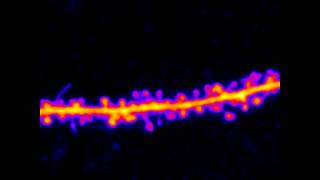 dendritic spines and filopodia [upl. by Regnij]