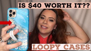 LOOPY Case Review NOT SPONSORED [upl. by Yazbak750]