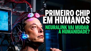 O QUE PODEREMOS FAZER Elon Musk confirma primeiro CHIP da Neuralink aplicado em cerebro humano [upl. by Akimaj]