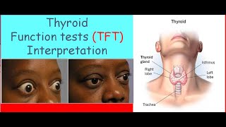 Lecture 9 2Thyroid Function Tests interpretation [upl. by Mathre]