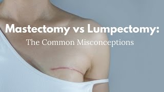 Mastectomy vs Lumpectomy The Common Misconceptions [upl. by Friedly927]