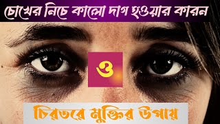 darkcercel চোখের নীচে কালো দাগ [upl. by Fraase700]