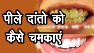 Teeth cleaning and polishing danto ki safai [upl. by Bo403]