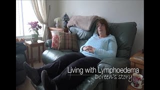 Living With Lymphoedema  Doreens Story Full [upl. by Graehme]