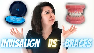 Ortho Talk with Dr Daher  Braces VS Invisalign [upl. by Trebbor]