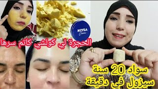 كنز في الحجر الأصفر💰سر من أسرار مراكز التجميل للقضاء على الكلف والتصبغات ولاطراس دلحبوب💃 [upl. by Clementine]