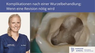 Komplikationen nach einer Wurzelbehandlung Wenn eine Revision nötig wird [upl. by Neomah]