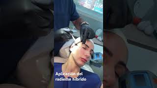 RADIESSE HÍBRIDO Belotero Tratamiento para tensar y rejuvenecer el rostro [upl. by Docilla]