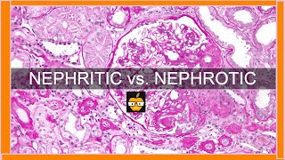 Nephritic vs Nephrotic Syndromes [upl. by Rilda117]