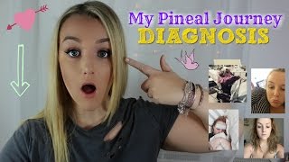 MY PINEAL JOURNEY PART 1  DIAGNOSIS [upl. by Mccurdy117]