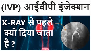 Intravenous Pyelogram in Hindi  Intravenous Pyelogram Procedure  IVP Test for Kidney [upl. by Sydney]