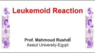 Leukemoid Reaction Arabic 2017 [upl. by Denie317]