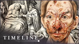 The True Terrors Of Tudor Medicine  Hidden Killers  Timeline [upl. by Bostow]