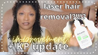 KP update 2 x Laser Hair removal on black woman  Products for KP Chicken Skin Bumpy Dry Skin [upl. by Nasus]