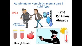 Autoimmune Hemolytic Anemia part 2 cold type [upl. by Riana]