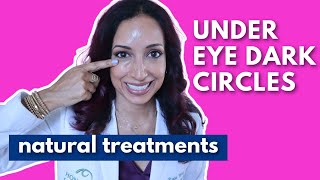 Eye Doctor Explains How To Get Rid Of Dark Under Eye Circles Naturally [upl. by England]