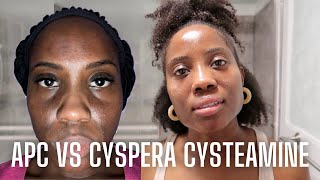 APC Cysteamine vs Cyspera Cysteamine [upl. by Meraree]