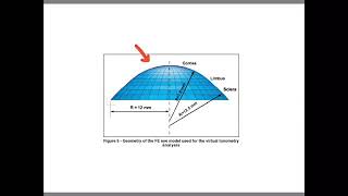 Keratometry  2nd grade  Instruments [upl. by Runkle]