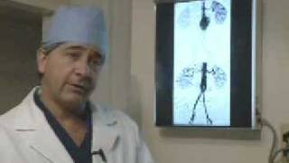 Abdominal Aortic Aneurysm Repair [upl. by Chemesh]