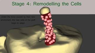 The Healing Process of the ACL Graft [upl. by Annayr]