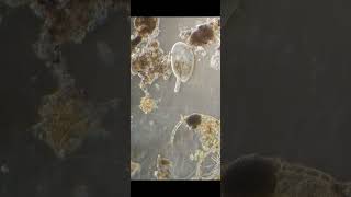 Frontonia poops a diatom aquarium science microscope nature biology [upl. by Keverian]