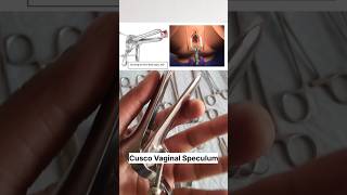 Cusco vaginal speculum surgicaldevice surgicaltraining gynecology medman papsmear [upl. by Eyanaj]