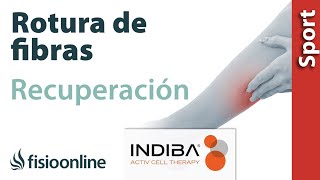 Acelera la recuperación de una rotura de fibras con INDIBA ACTIV [upl. by Darb]