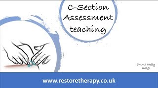 csection scar assessment teaching therapists what to look for [upl. by Grussing]