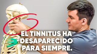 Las 3 principales causas del tinnitus ¡Hice esto y todo desapareció [upl. by Dalli]