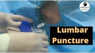 Lumbar Puncture Procedure in just 11 mins [upl. by Lonergan]