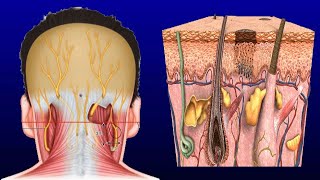 Swollen Occipital Lymph Node Causes And Treatment [upl. by Chrystel41]