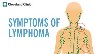 Warning Signs of Lymphoma [upl. by Ramona223]