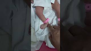 Physical examination foot deformity congenital talipes calcaneovalgus tight muscle positional [upl. by Asela]