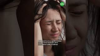 Proven Home Remedies To Cure Dandruff I OnlyMyHealth [upl. by Rubens91]