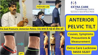 Anterior Pelvic Tilt  Symptoms Causes Precautions amp Measurement  कमर के गड्ढे को ठीक करें [upl. by Nilok]