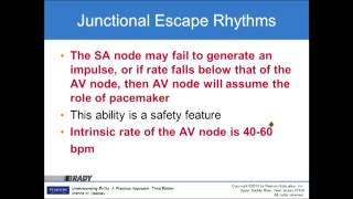 Basic EKG Chapter 9 Junctional Rhythms [upl. by Boj]