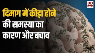 Neurocysticercosis  दिमाग में कीड़ा होने की समस्या का कारण और बचाव [upl. by Rebmaed]