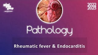 L4 Part1  Rheumatic Heart Disease Pathology [upl. by Orfield]