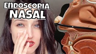 MINHA EXPERIÊNCIA COM A ENDOSCOPIA NASAL  Crises de rinite e como descobri meu desvio de septo [upl. by Torras]