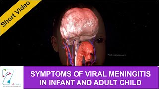 SYMPTOMS OF VIRAL MENINGITIS IN INFANT AND ADULT CHILD [upl. by Anilag]