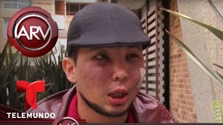 Joven quería ser más guapo y terminó desfigurado  Al Rojo Vivo  Telemundo [upl. by Murdoch]