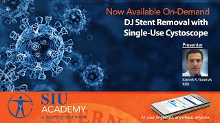 Clip DJ Stent Removal With Single Use Cystoscope [upl. by Einnaoj607]