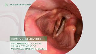 Disfonía Lesiones de las cuerdas vocales [upl. by Viehmann739]