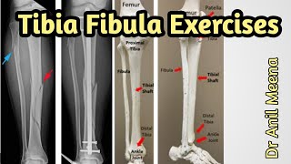 tibia fibula fracture exercises  tibia fracture recovery exercises  tibia fracture physiotherapy [upl. by Beilul152]