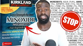 Why I STOPPED USING Minoxidil to Improve my Beard Growth  Dont use Minoxidil Before Watching This [upl. by Kirkwood]