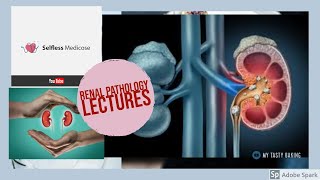 RENAL PATHOLOGY lecture 19 CHRONIC KIDNEY DISEASE  must watch to grab it [upl. by Enal]