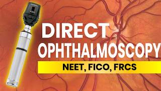 Direct Ophthalmoscopy Tips and Tricks [upl. by Teriann]