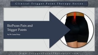 IlioPsoas Pain and Trigger Points [upl. by Alim911]